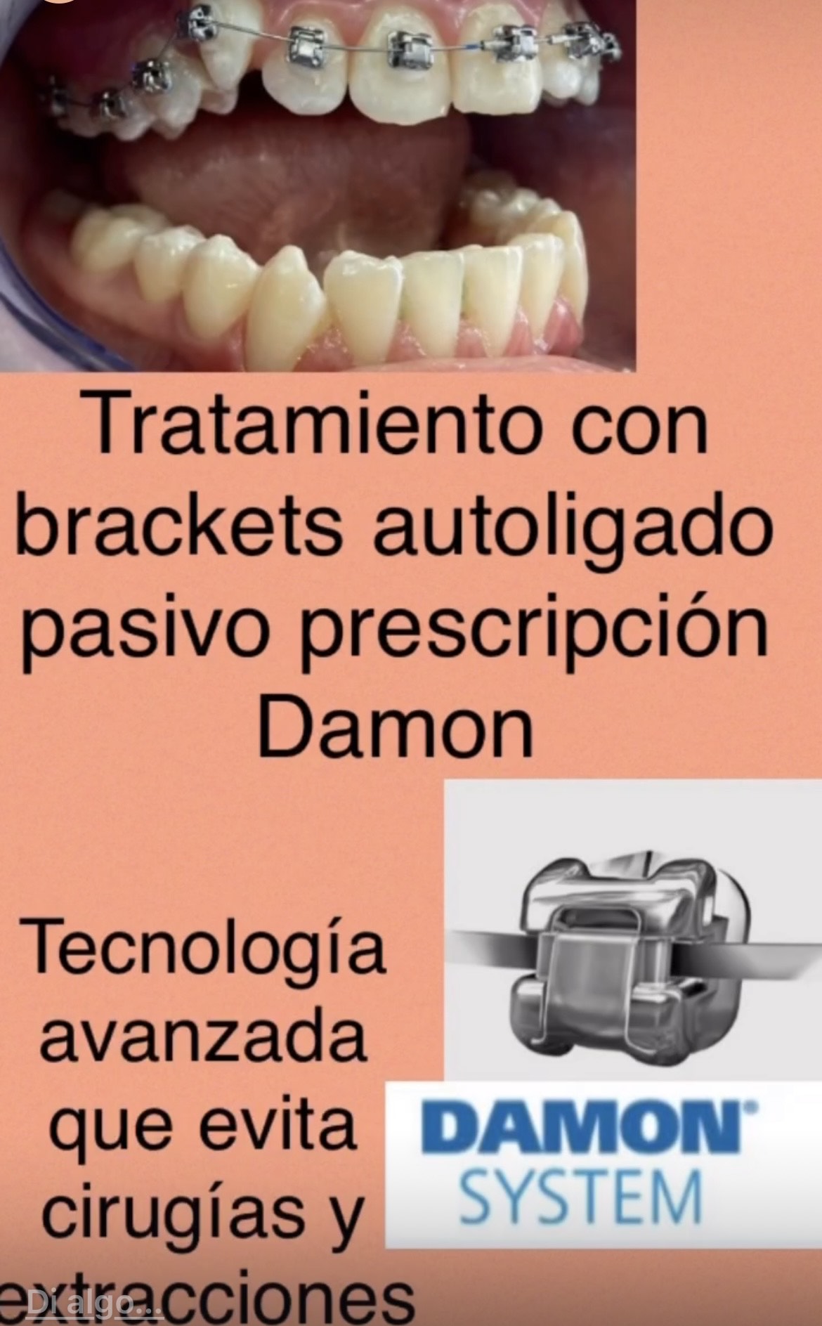 Caso Damon 5