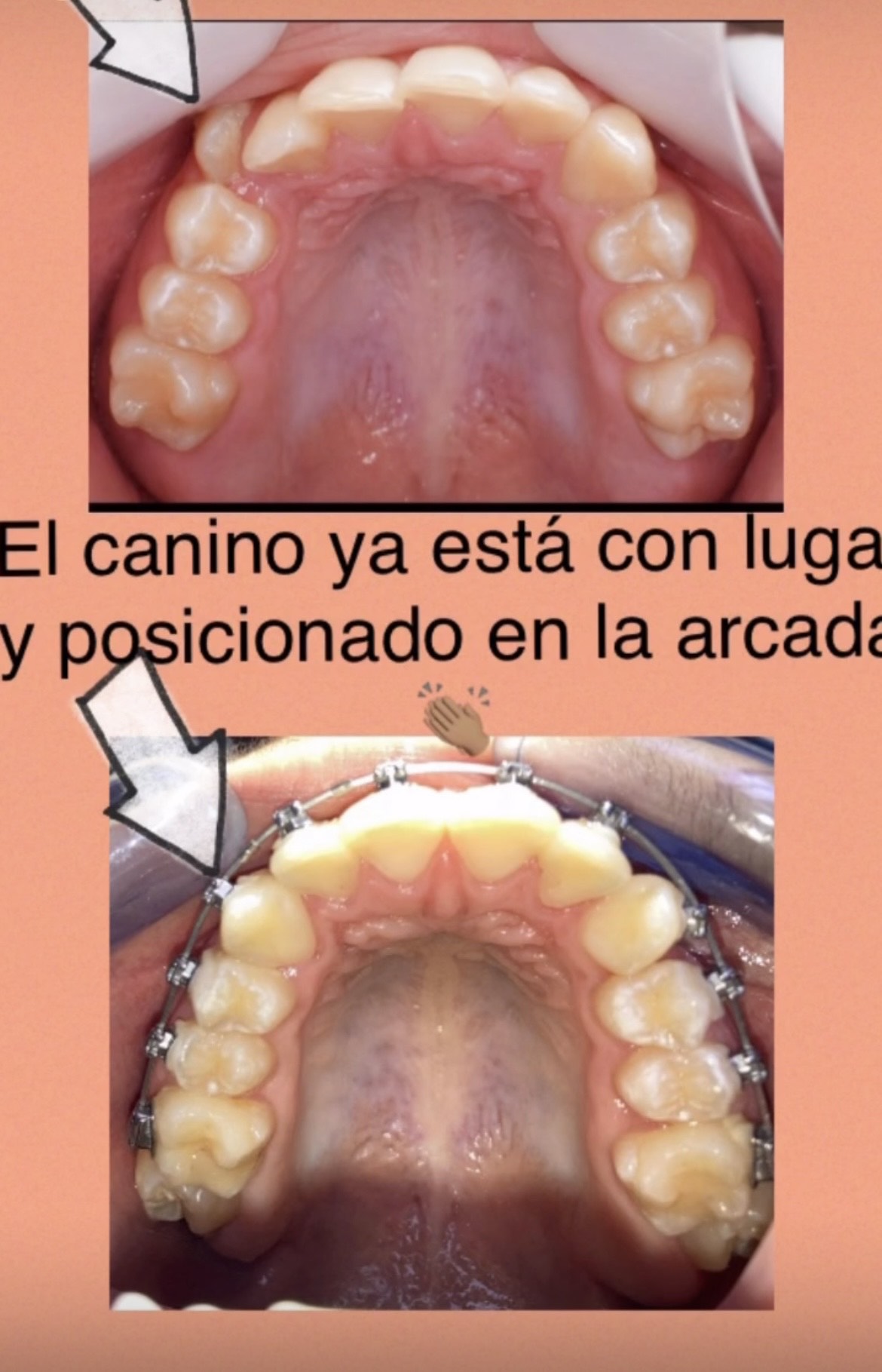 Caso Damon 4