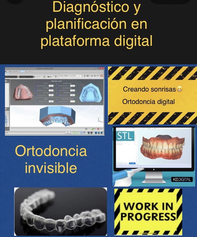 Caso 4