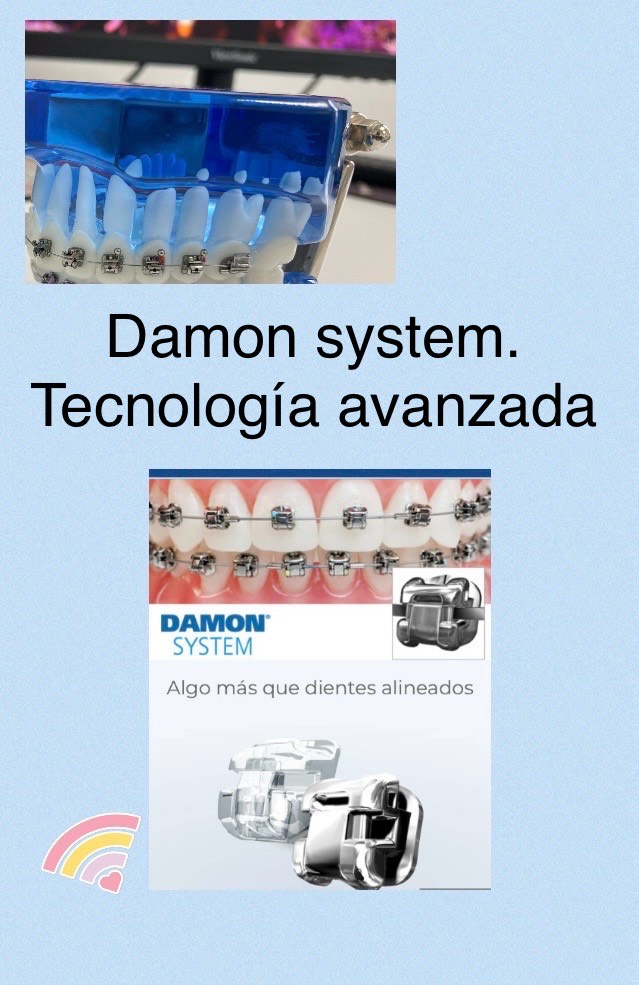 Bracket Damon
