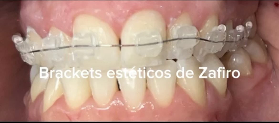 Caso 5