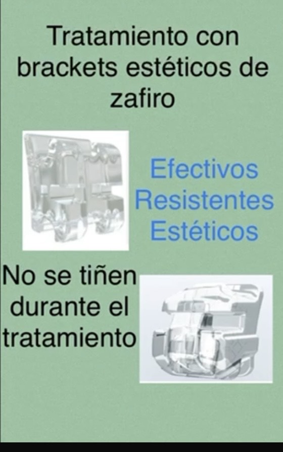 Brackets Estéticos detalle