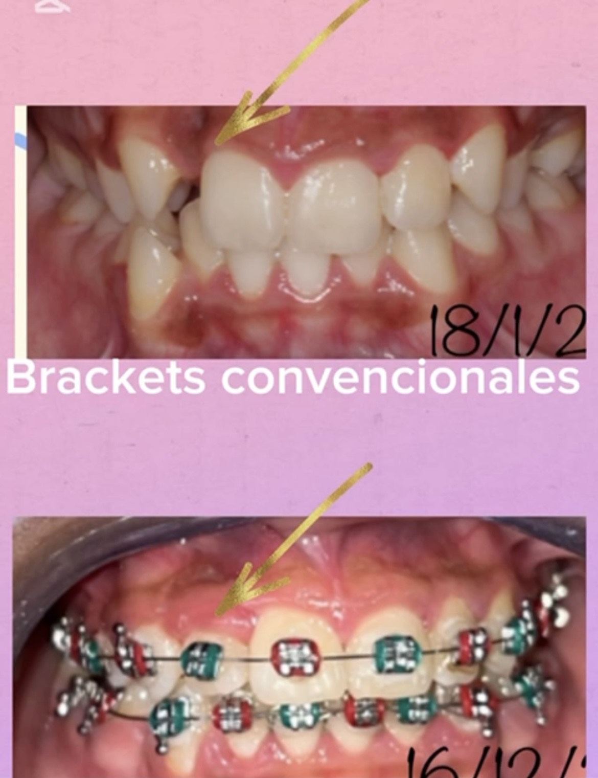 Caso 5