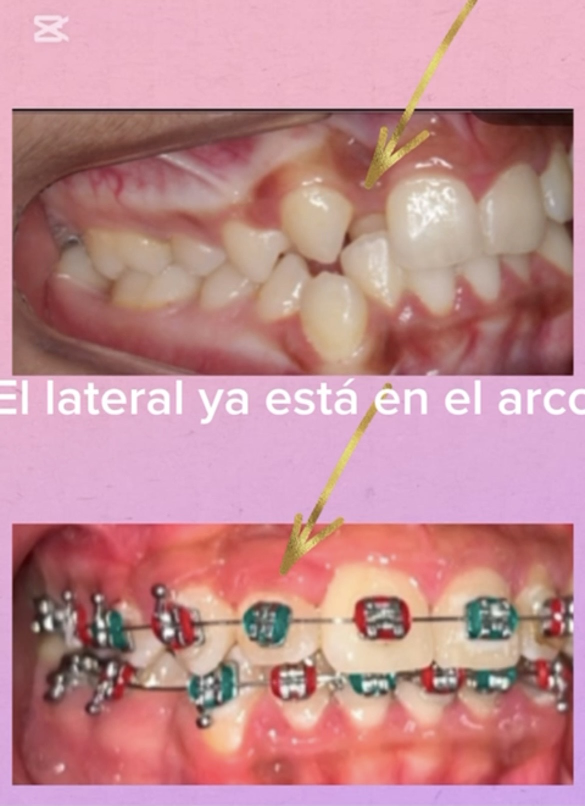 Caso 4