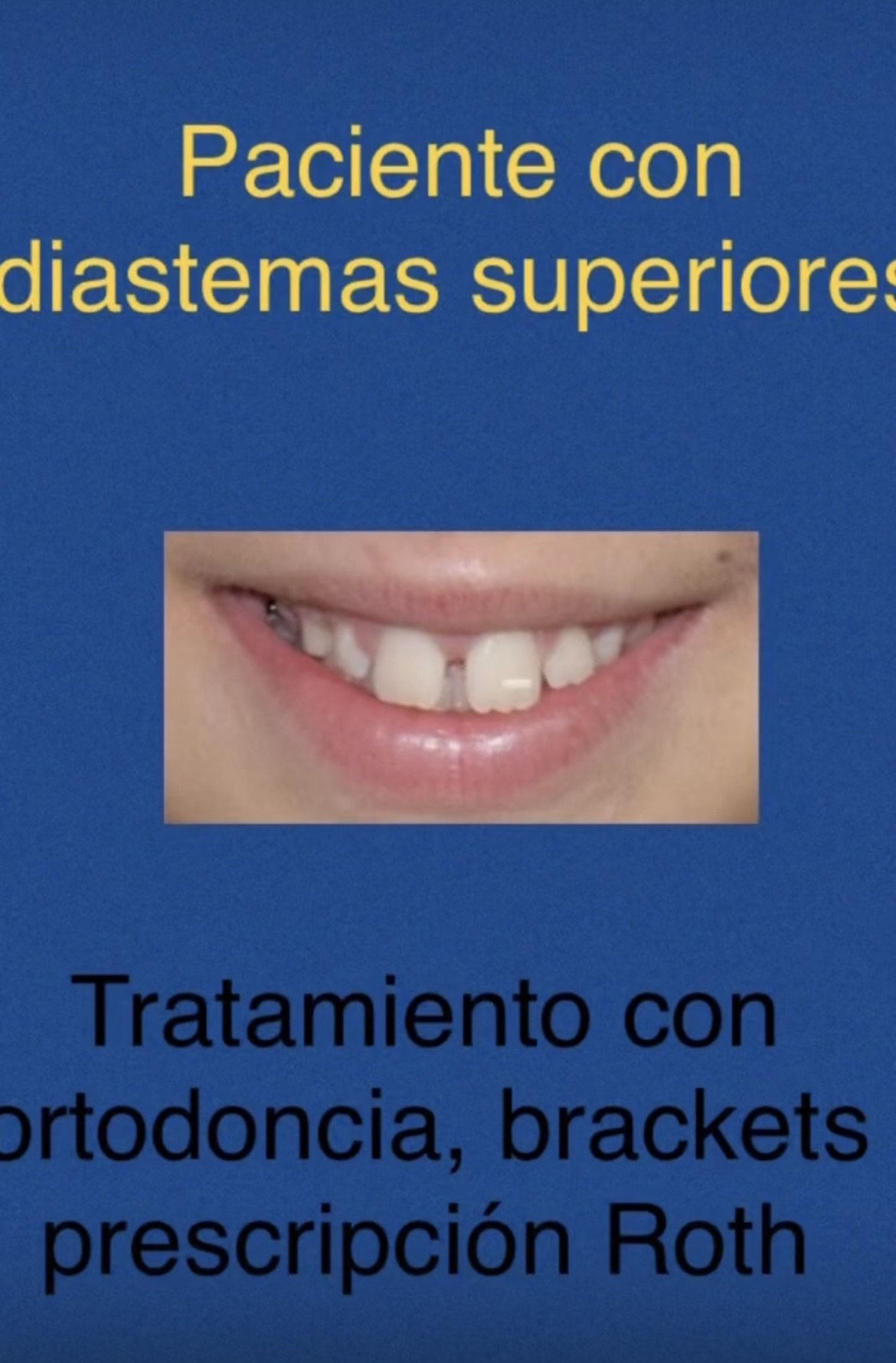 Ortodoncia