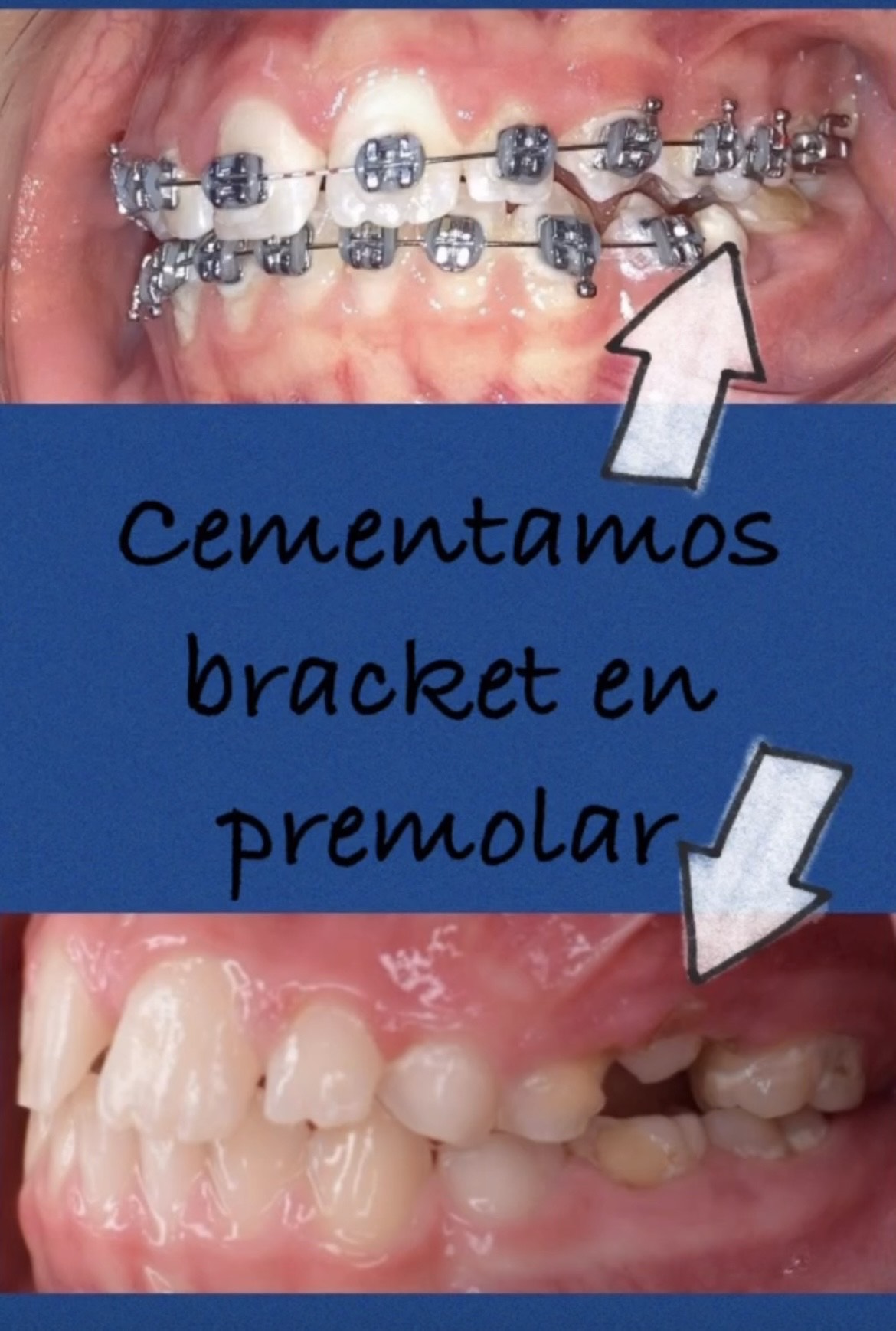 Caso 8