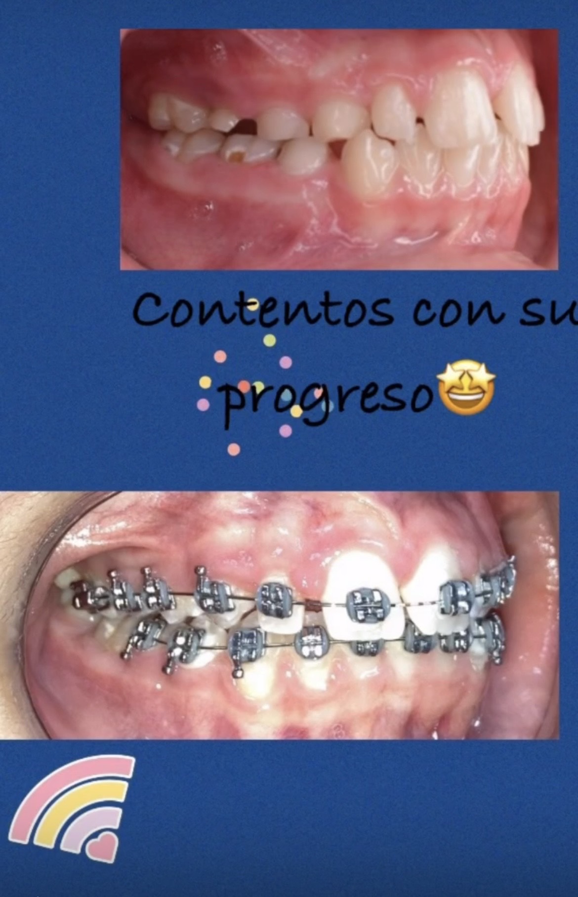 Caso 5